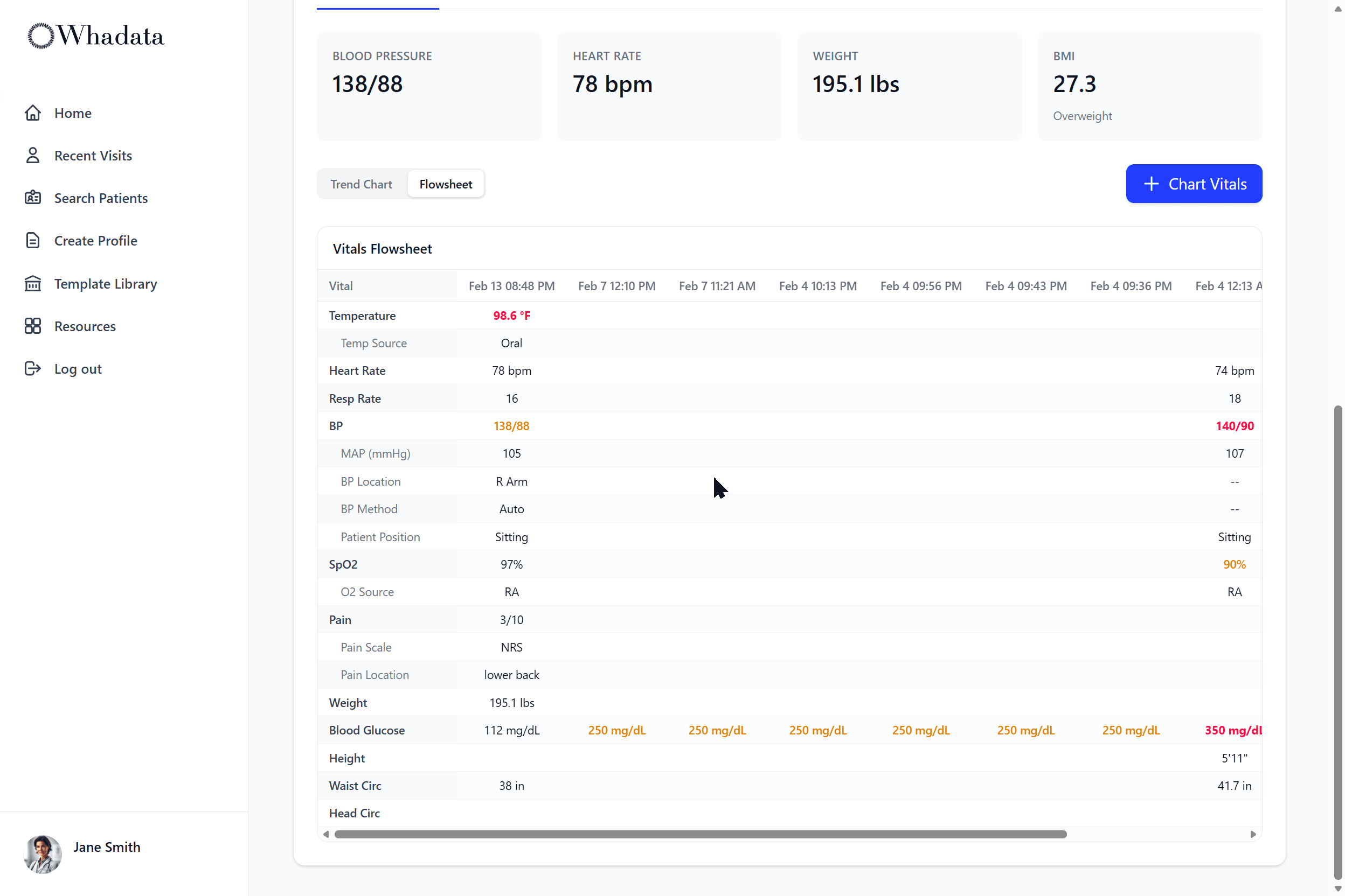Whadata Insights - Flowsheet
